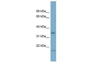 IGFBP2 antibody used at 1 ug/ml to detect target protein.
