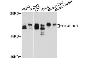Western blot analysis of extracts of various cell lines, using EIF4EBP1 antibody (ABIN5970590) at 1/1000 dilution. (eIF4EBP1 Antikörper)