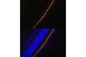 Immunofluorescence analysis of Rat eye cells using RPE65 antibody (ABIN6130679, ABIN6147090, ABIN6147091 and ABIN6225161) at dilution of 1:100. (RPE65 Antikörper  (AA 274-533))