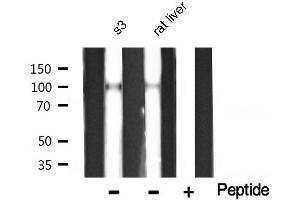 Western blot analysis of Catenin α1 expression in S3/rat liver tissue lysates,The lane on the right is treated with the antigen-specific peptide. (CTNNA1 Antikörper  (C-Term))