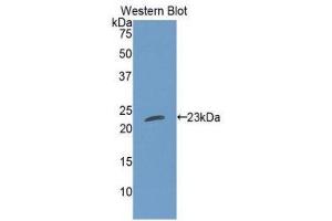 Western Blotting (WB) image for anti-Cardiotrophin 1 (CTF1) (AA 1-201) antibody (ABIN3207807) (Cardiotrophin 1 Antikörper  (AA 1-201))