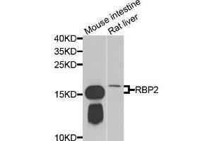 Western blot analysis of extracts of mouse intestine and rat liver cells, using RBP2 antibody.