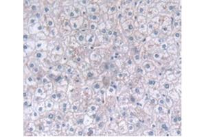 Detection of CLEC4C in Human Liver Tissue using Polyclonal Antibody to C-Type Lectin Domain Family 4, Member C (CLEC4C)