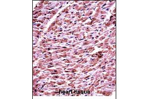 DHRS7C Antibody (Center) ((ABIN657710 and ABIN2846701))immunohistochemistry analysis in formalin fixed and paraffin embedded human heart tissue followed by peroxidase conjugation of the secondary antibody and DAB staining. (DHRS7C Antikörper  (AA 116-145))