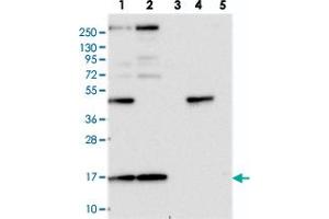 Western blot analysis of Lane 1: RT-4, Lane 2: U-251 MG, Lane 3: Human Plasma, Lane 4: Liver, Lane 5: Tonsil with RPS19BP1 polyclonal antibody  at 1:250-1:500 dilution.