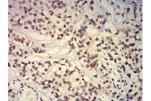 Immunohistochemistry (IHC) image for anti-Ankyrin Repeat-Containing Protein (EHMT2) (AA 317-471) antibody (ABIN7193340)