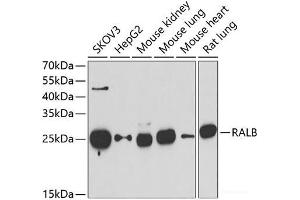 Western blot analysis of extracts of various cell lines using RALB Polyclonal Antibody at dilution of 1:1000. (RALB Antikörper)