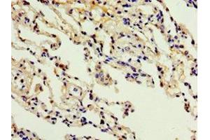 Immunohistochemistry of paraffin-embedded human lung tissue using ABIN7150057 at dilution of 1:100 (ADAM33 Antikörper  (AA 140-420))