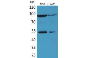 Western Blotting (WB) image for anti-Endothelial PAS Domain Protein 1 (EPAS1) (Ser343) antibody (ABIN3178355) (EPAS1 Antikörper  (Ser343))