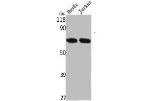Western Blot analysis of HuvEc Jurkat cells using STK33 Polyclonal Antibody (STK33 Antikörper  (N-Term))
