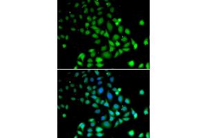 Immunofluorescence analysis of U2OS cells using PARN antibody. (PARN Antikörper)