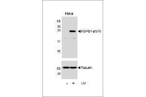 Western blot analysis of lysates from Hela cell line, untreated or treated with UV, 2 hours, using HSPB1 Antibody (R)(upper) or Tubulin (lower). (HSP27 Antikörper  (pSer78))