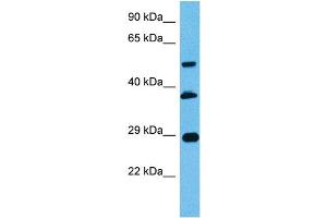 Host:  Mouse  Target Name:  PBX2  Sample Tissue:  Mouse Pancreas  Antibody Dilution:  1ug/ml (PBX2 Antikörper  (N-Term))
