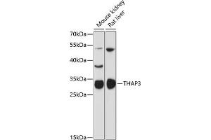 Western blot analysis of extracts of various cell lines, using TH antibody (ABIN6132722, ABIN6149110, ABIN6149112 and ABIN6216701) at 1:3000 dilution. (THAP3 Antikörper  (AA 1-239))