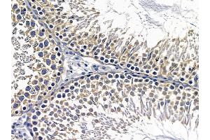 ABIN6257467 and ABIN6274784 at 1/100 staining rat testis tissue by IHC-P. (RPL7 Antikörper  (C-Term))