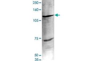 Nuclear extracts of HeLa cells (40 ug) were analysed by Western blot using Ehmt1 polyclonal antibody  diluted 1 : 1,000 in TBS-Tween containing 5% skimmed milk. (EHMT1 Antikörper)