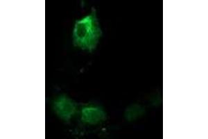 Anti-TACC3 mouse monoclonal antibody (ABIN2453828) immunofluorescent staining of COS7 cells transiently transfected by pCMV6-ENTRY TACC3 (RC210754). (TACC3 Antikörper)