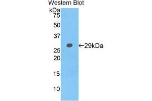 Western Blotting (WB) image for anti-Neurofascin (NFASC) (AA 760-1007) antibody (ABIN1859997) (NFASC Antikörper  (AA 760-1007))