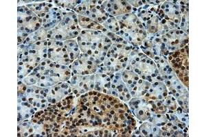 Immunohistochemistry (IHC) image for anti-Induced Myeloid Leukemia Cell Differentiation Protein Mcl-1 (MCL1) antibody (ABIN1499337) (MCL-1 Antikörper)