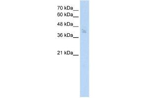 WB Suggested Anti-SPDEF Antibody Titration: 2. (SPDEF/PSE Antikörper  (N-Term))