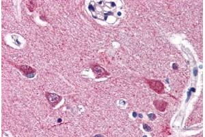 Human Brain, Cortex (formalin-fixed, paraffin-embedded) stained with VGF antibody ABIN337343 at 5 ug/ml followed by biotinylated goat anti-rabbit IgG secondary antibody ABIN481713, alkaline phosphatase-streptavidin and chromogen. (VGF Antikörper  (C-Term))