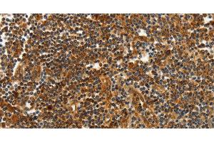 Immunohistochemistry of paraffin-embedded Human tonsil tissue using CNNM3 Polyclonal Antibody at dilution 1:40 (Cyclin M3 Antikörper)