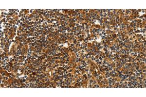 Immunohistochemistry of paraffin-embedded Human tonsil tissue using CNNM3 Polyclonal Antibody at dilution 1:40