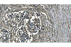IHC analysis of GNG7 using anti-GNG7 antibody (ABIN7600508). (GNG7 Antikörper  (AA 2-57))