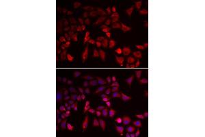 Immunofluorescence analysis of MCF-7 cells using PYGL antibody. (PYGL Antikörper  (AA 1-280))