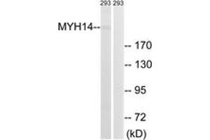 Western blot analysis of extracts from 293 cells, using MYH14 Antibody.