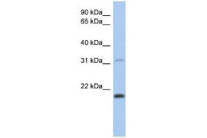 CLECL1 antibody used at 1 ug/ml to detect target protein. (CLECL1 Antikörper  (Middle Region))