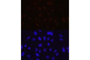 Immunofluorescence analysis of U-2 OS cells using MBNL1 Rabbit mAb (ABIN7268704) at dilution of 1:100 (40x lens). (MBNL1 Antikörper)