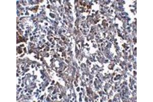 Immunohistochemistry (IHC) image for anti-ORAI Calcium Release-Activated Calcium Modulator 1 (ORAI1) antibody (ABIN1031711)
