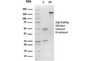 SDS-PAGE Analysis Purified p27 MAb (DCS-72. (CDKN1B Antikörper)