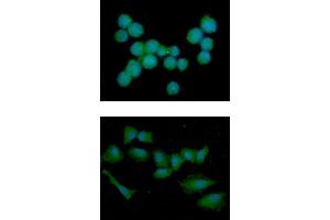 ICC/IF analysis of NBL1 in Jurkat cells line, stained with DAPI (Blue) for nucleus staining and monoclonal anti-human NBL1 antibody (1:100) with goat anti-mouse IgG-Alexa fluor 488 conjugate (Green). (NBL1 Antikörper)