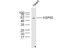 Western Blotting (WB) image for anti-Heat Shock 60kDa Protein 1 (Chaperonin) (HSPD1) (AA 501-573) antibody (ABIN726080)