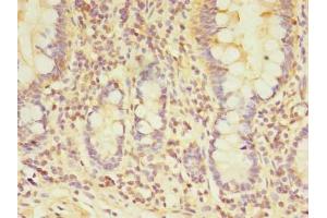 Immunohistochemistry of paraffin-embedded human small intestine tissue using ABIN7172078 at dilution of 1:100 (TARS2 Antikörper  (AA 369-718))