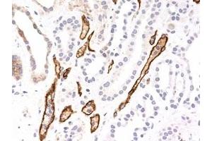 Formalin-fixed, paraffin-embedded human kidney transplant stained with Complement 4d antibody (SPM545). (Complement C4d Antikörper)