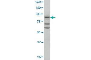 TAX1BP1 monoclonal antibody (M01), clone 2C3 Western Blot analysis of TAX1BP1 expression in A-431 .