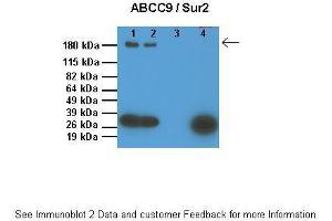 Lanes:   1: 10ug SUR1 KO mouse ventricle lysate, 2: 10ug WT mouse ventricle lysate, 3: 0. (ABCC9 Antikörper  (Middle Region))