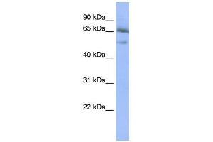 Western Blotting (WB) image for anti-Nuclear Factor of kappa Light Polypeptide Gene Enhancer in B-Cells Inhibitor, epsilon (NFKBIE) (Middle Region) antibody (ABIN927719)