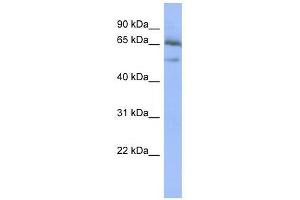 NFKBIE antibody used at 0. (NFKBIE Antikörper  (Middle Region))
