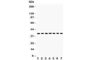 Western blot testing of PP2A antibody and Lane 1:  rat kidney;  2: mouse kidney;  3: human placenta;  4: (r) liver;  5: (m) NIH3T3;  6: (r) PC12;  7: (h) 293T lysate.