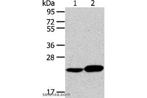 Western blot analysis of Human liver cancer tissue and hela cell, using RAB8A Polyclonal Antibody at dilution of 1:100
