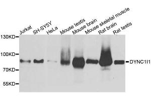 Western blot analysis of extracts of various cell lines, using DYNC1I1 antibody. (DYNC1I1 Antikörper  (AA 1-220))