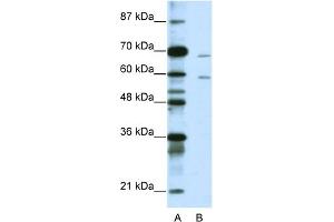 WB Suggested Anti-FOXA2 Antibody Titration:  1. (FOXA2 Antikörper  (N-Term))