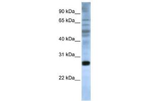 EIF4E antibody used at 1 ug/ml to detect target protein. (EIF4E Antikörper  (C-Term))