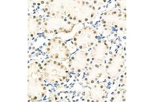 Immunohistochemistry of paraffin embedded rat kidney using NPEPL1 (ABIN7073185) at dilution of 1:100 (400x lens) (BIVM Antikörper)