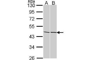 Western Blotting (WB) image for anti-Adenosine Kinase (ADK) antibody (ABIN2855027)