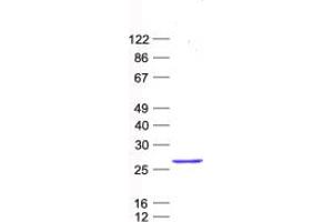 Validation with Western Blot (CNIH4 Protein (His tag))